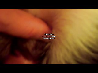 Down Syndrome Xxx Porn